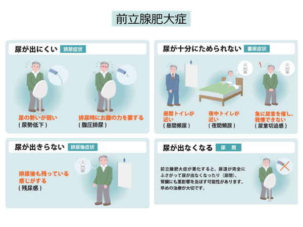 泌尿器科 診療科案内 診療科・部門案内 成田富里徳洲会病院